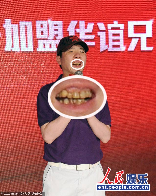 冯小刚嗜烟如命满嘴黄牙骇人 当众提裤很随意【2】